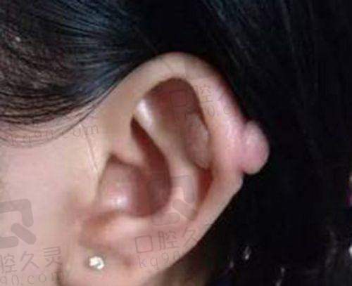 南宁碧莲盛植发医院正规吗？