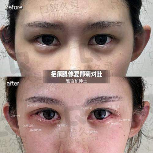 北京睐美安王恒医生黑料不可信：黑稿真相大揭秘