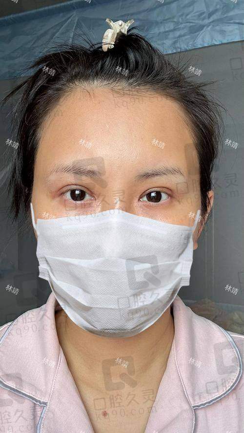 北京睐美安王恒医生之所以备受欢迎，是因为他真的技术硬