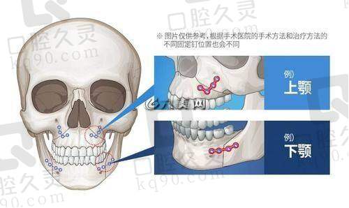 上海首尔丽格朴兴植医生实力如何？