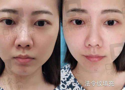 宋建星修复口碑怎么样？“自然”“无痕”“满意度高”是他的标签