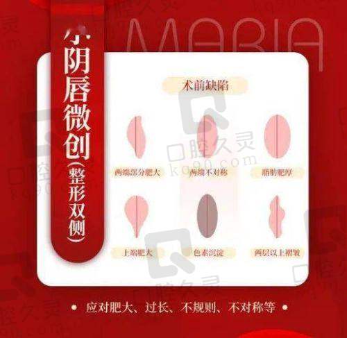 紧缩手术有副作用吗——了解紧缩手术