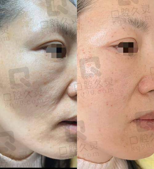 医院收费合理吗？价格透明，没有隐形消费