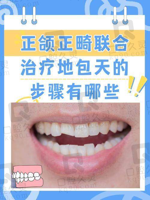 上海首尔丽格崔荣达医生地包天单颚矫正适合哪些人？