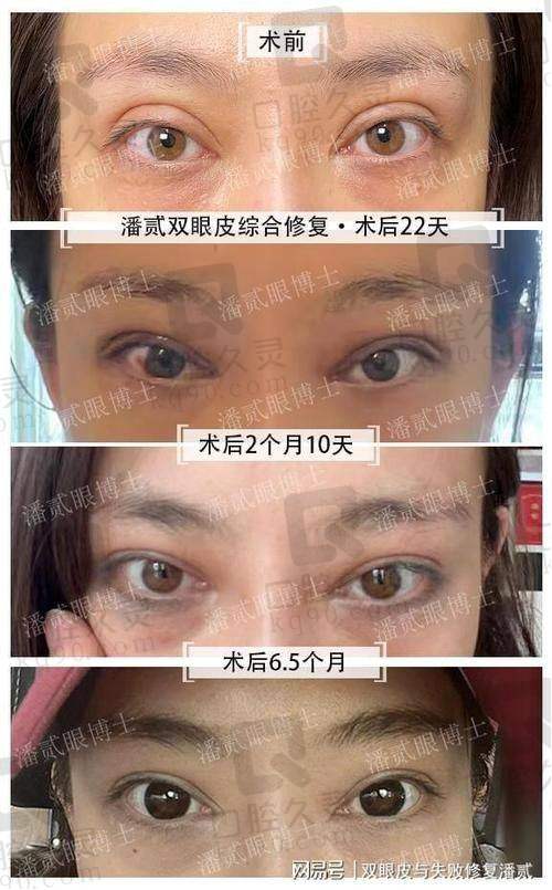 别再被骗了！真实的挂号方式请收藏