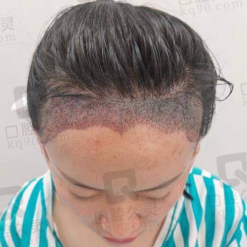 五、洛阳未毛植发诊所医生介绍