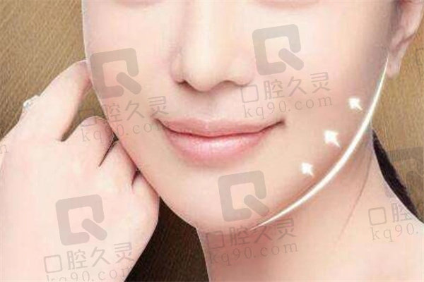 重庆星荣刘正茂院长下颌角+下巴+颧骨+颧弓+颊脂垫面部轮廓综合5项8万起，开启精致美颜新旅程
