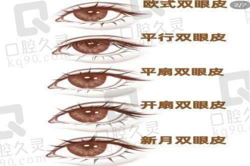 刘平眼修复价目表大揭秘！含坐诊信息、优势及术后护理全攻略