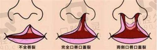 总结