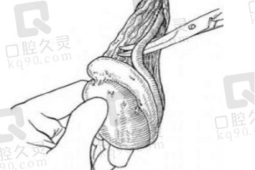 五、贵阳爱尔丽医疗美容医生预约挂号攻略
