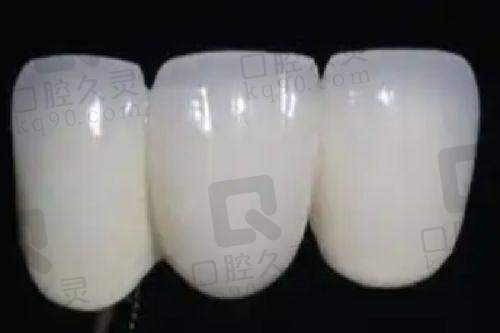 亲身体验，上海英博旭日口腔的拔牙服务的优势
