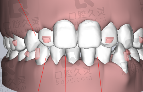 上海英博旭日口腔拔牙技术特点