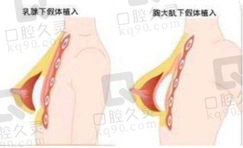 成都锦江润美晶肤医疗美容门诊部郭增医生的口碑评价