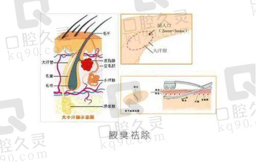 佛山曙光金子医学美容医院李方文医生特色技术优势