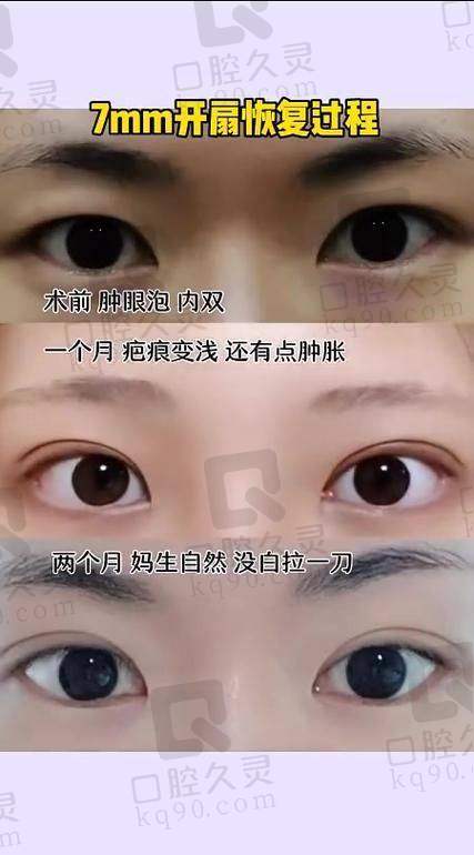 三类人群适合不同的挂号方式，看你属于哪一类