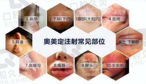 二、吴继东医生擅长的隆胸技术