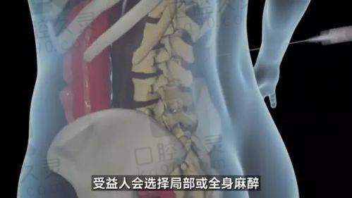 三、吴继东医生隆胸技术优势