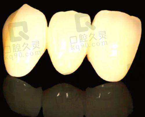 惠州麦芽口腔德国威兰德全瓷牙价格2180元起一颗，套餐丰富服务贴心畅享口腔修复盛宴