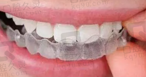 深圳美莱口腔医院预约电话多少？拨打0755-840009**进行预约，方便患者预约