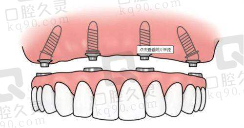 1. 通辽斯迈尔口腔门诊部｜种牙优选全线服务