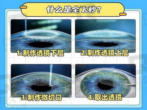 湛江爱尔奥理德眼科医院林瑞杰现任职医院价格表