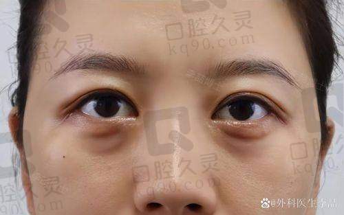 传言中的“失败实例”到底从哪来的？深圳本地用户怎么说？