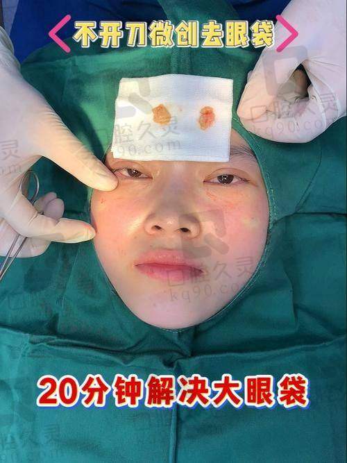 7D去眼袋到底是啥？朱冠峰医生技术有何不同？