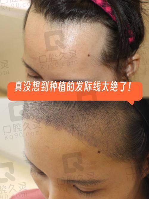 六、贵阳丽都植发医院收费明细表
