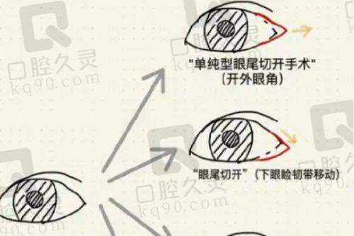 辽宁曙光整形外科医院车金昊医生特色技术优势
