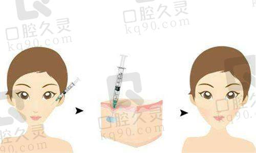 杨俊斐医生擅长项目