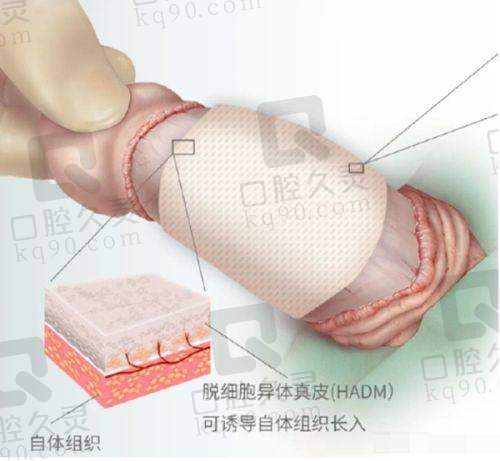 杨俊斐医生特色技术优势