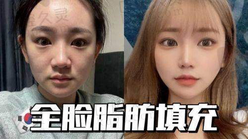三、高存活率背后的技术支撑