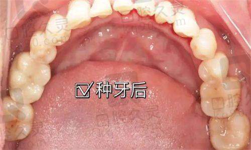 六、结语：总结+懒人懒人版建议