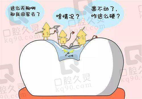 厦门麦芽口腔儿童窝沟封闭项目是什么原理？