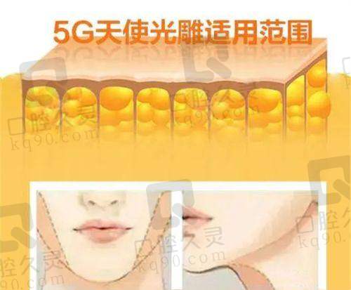 2025修复双眼皮的十大医生排名榜都有谁？