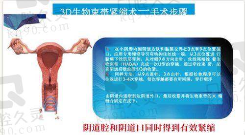 西宁韩美整形美容医院口碑好吗？专业设备、优质医生打造理想医美体验