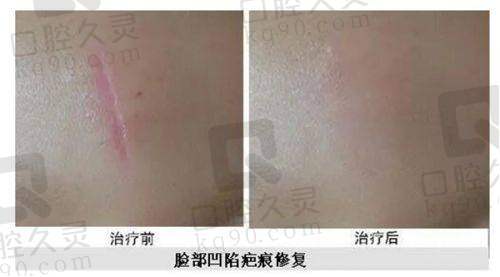 西宁韩美美容医院注射项目整体优势