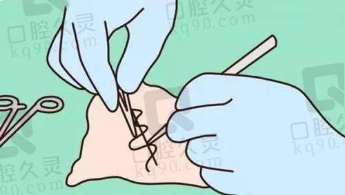 李生梅医生注射项目特色优势
