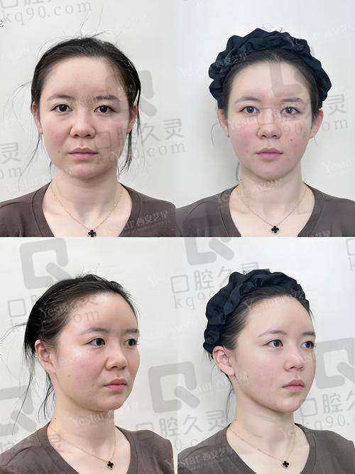 三、汪树杰技术怎么样？