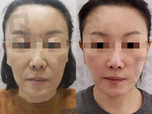 六、汪树杰怎么预约？