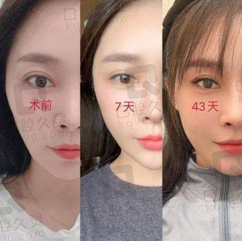 一、冯斌医生：脂肪界的大师