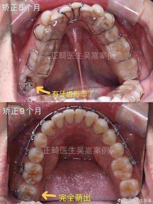 沈阳盛大口腔其他项目价格详情