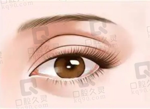 北京嘉禾李燕切开双眼皮5200元起，睑缘隐痕缝合，术后效果自然美观超惊艳