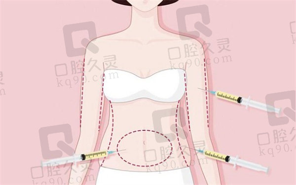乌鲁木齐华美整形腰腹水动力吸脂价格6666元起，玛丽亚副院长助你轻松塑造迷人腰腹