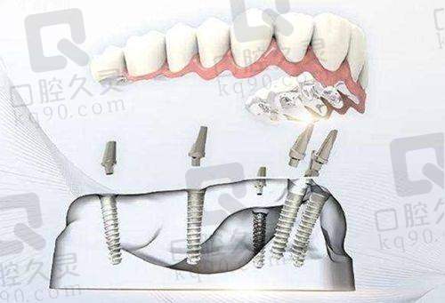 深圳登特口腔官网简介：精良设备带来怎样的体验？