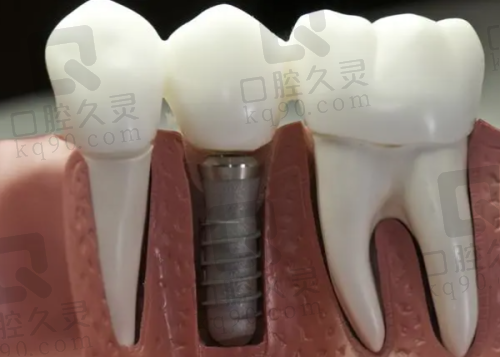 四、红河蒙自吉祥口腔