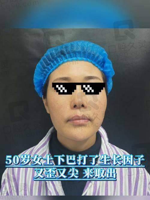 王洪医生面部馒化修复多少钱？价格透明，性价比高