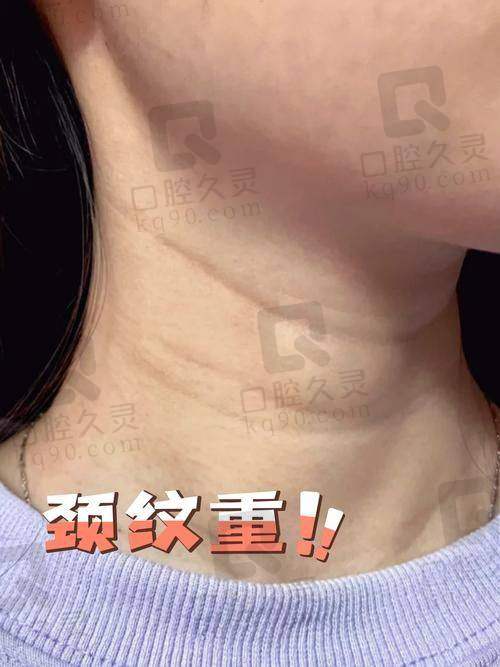四、美学提示与风险注意事项