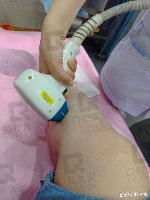 喀什时光医疗美容激光脱毛380元起，精良设备，专业医生操作，成效持久超省心