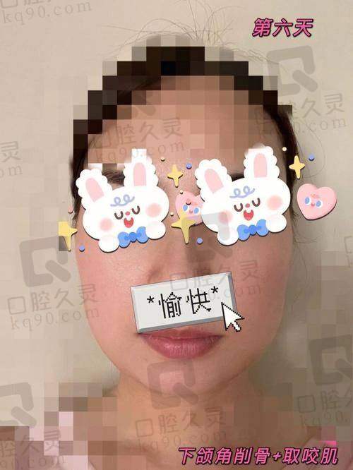 三、籍建华磨骨技术特点
